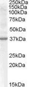 Renalase, FAD Dependent Amine Oxidase antibody, PA5-18736, Invitrogen Antibodies, Western Blot image 