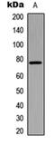 BMX Non-Receptor Tyrosine Kinase antibody, orb304704, Biorbyt, Western Blot image 
