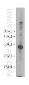 Origin Recognition Complex Subunit 6 antibody, 17784-1-AP, Proteintech Group, Western Blot image 