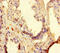 Putative ATP-dependent RNA helicase TDRD9 antibody, MBS969989, MyBioSource, Immunohistochemistry paraffin image 