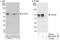 Forkhead Box N3 antibody, NBP2-04051, Novus Biologicals, Immunoprecipitation image 