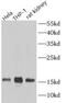 Translocase Of Outer Mitochondrial Membrane 20 antibody, FNab08858, FineTest, Western Blot image 