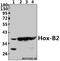 Homeobox B2 antibody, A06207-1, Boster Biological Technology, Western Blot image 