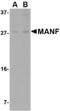 ARP antibody, LS-C53208, Lifespan Biosciences, Western Blot image 