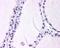 Lysophosphatidylcholine Acyltransferase 1 antibody, GTX85693, GeneTex, Immunohistochemistry paraffin image 