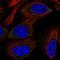 Ribosomal Protein S12 antibody, HPA006365, Atlas Antibodies, Immunocytochemistry image 