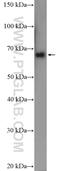 Potassium voltage-gated channel subfamily A member 5 antibody, 21659-1-AP, Proteintech Group, Western Blot image 