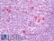 Protein Mdm4 antibody, LS-B9824, Lifespan Biosciences, Immunohistochemistry frozen image 