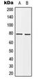 BRCA1 Associated RING Domain 1 antibody, GTX55221, GeneTex, Western Blot image 