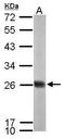 NADH dehydrogenase [ubiquinone] iron-sulfur protein 8, mitochondrial antibody, TA307971, Origene, Western Blot image 