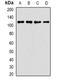 Ankyrin Repeat Domain 52 antibody, orb341489, Biorbyt, Western Blot image 