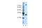 Serine And Arginine Rich Splicing Factor 10 antibody, ARP41082_P050, Aviva Systems Biology, Western Blot image 