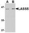 Ceramide Synthase 5 antibody, NBP1-77329, Novus Biologicals, Western Blot image 