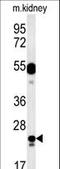 LysM Domain Containing 1 antibody, LS-C163944, Lifespan Biosciences, Western Blot image 