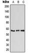 ATPase H+ Transporting V1 Subunit B1 antibody, orb213593, Biorbyt, Western Blot image 
