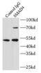 Dpc4 antibody, FNab07995, FineTest, Immunoprecipitation image 