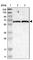 Intermediate Filament Family Orphan 2 antibody, HPA015987, Atlas Antibodies, Western Blot image 