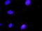 Disheveled-associated activator of morphogenesis 1 antibody, H00023002-M03, Novus Biologicals, Proximity Ligation Assay image 