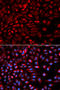 NIMA Related Kinase 2 antibody, A01606-1, Boster Biological Technology, Western Blot image 