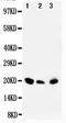 Dual specificity protein phosphatase 3 antibody, PA1762, Boster Biological Technology, Western Blot image 