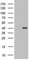 Ornithine Carbamoyltransferase antibody, TA802679, Origene, Western Blot image 