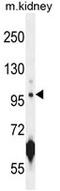 Carnosine Synthase 1 antibody, AP50310PU-N, Origene, Western Blot image 