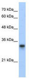 Ribosomal Protein L8 antibody, TA345688, Origene, Western Blot image 