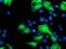 Serine/threonine-protein kinase Nek9 antibody, TA503326, Origene, Immunofluorescence image 