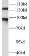 Palladin, Cytoskeletal Associated Protein antibody, FNab06126, FineTest, Western Blot image 