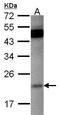 Ras-related protein Rap-1b antibody, GTX101950, GeneTex, Western Blot image 
