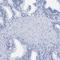 Hyaluronan And Proteoglycan Link Protein 1 antibody, HPA019105, Atlas Antibodies, Immunohistochemistry frozen image 