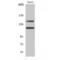 c-Kit antibody, LS-C380699, Lifespan Biosciences, Western Blot image 