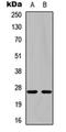 Nerve Growth Factor antibody, orb256721, Biorbyt, Western Blot image 