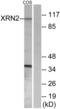 5'-3' Exoribonuclease 2 antibody, LS-C119255, Lifespan Biosciences, Western Blot image 