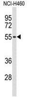 BNC1 antibody, AP50043PU-N, Origene, Western Blot image 