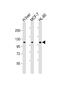 Round Spermatid Basic Protein 1 antibody, PA5-48230, Invitrogen Antibodies, Western Blot image 