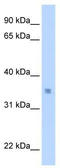 Max-like protein X antibody, TA345583, Origene, Western Blot image 