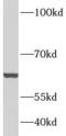 Carnitine O-Acetyltransferase antibody, FNab01952, FineTest, Western Blot image 