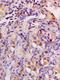 Tumor Protein P63 antibody, orb389280, Biorbyt, Immunohistochemistry paraffin image 