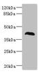 NHL Repeat Containing E3 Ubiquitin Protein Ligase 1 antibody, LS-C676159, Lifespan Biosciences, Western Blot image 