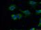 Carbonic Anhydrase 13 antibody, 16696-1-AP, Proteintech Group, Immunofluorescence image 