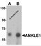 Ankyrin Repeat And LEM Domain Containing 1 antibody, 6607, ProSci, Western Blot image 