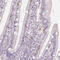 CD69 Molecule antibody, HPA050525, Atlas Antibodies, Immunohistochemistry paraffin image 