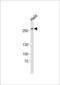AT-Hook Containing Transcription Factor 1 antibody, MBS9203401, MyBioSource, Western Blot image 