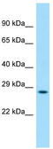 Leucine Zipper Protein 4 antibody, TA334319, Origene, Western Blot image 