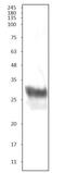 CD8 antibody, GTX03377, GeneTex, Western Blot image 
