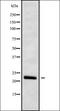 Interferon Omega 1 antibody, orb336294, Biorbyt, Western Blot image 