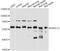 Pre-MRNA Processing Factor 31 antibody, A5732, ABclonal Technology, Western Blot image 