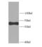 Sequestosome 1 antibody, FNab06087, FineTest, Western Blot image 