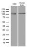 Argonaute RISC Component 1 antibody, M00826, Boster Biological Technology, Western Blot image 